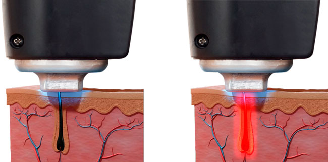 マイルズマンコンパクト