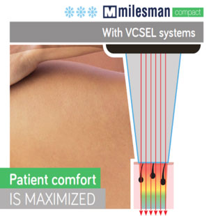 VCSELシステム使用の場合