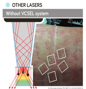 VCSELシステム不採用の場合